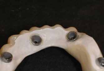Estetica dentale in BioHPP
