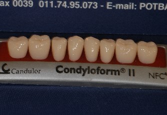 All-on-four e All-on-six inferiori
