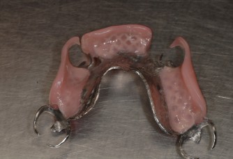 Dispositivi in Metallo-Nylon