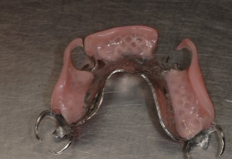 Protesi dentali invisibili