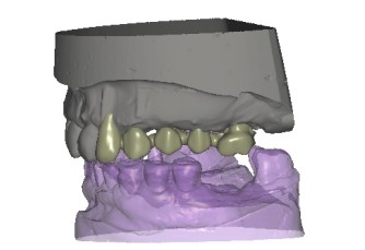 Vantaggi della tecnologia CAD/CAM