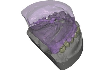 Vantaggi della tecnologia CAD/CAM