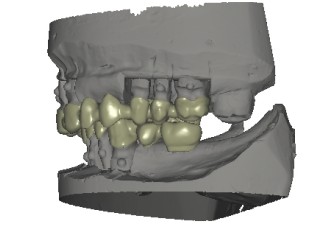 Affidabilità della tecnologia CAD/CAM