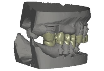 Affidabilità della tecnologia CAD/CAM