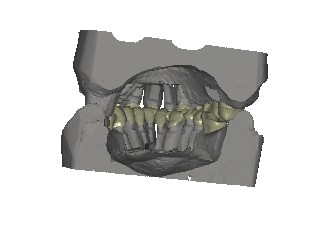 Affidabilità della tecnologia CAD/CAM