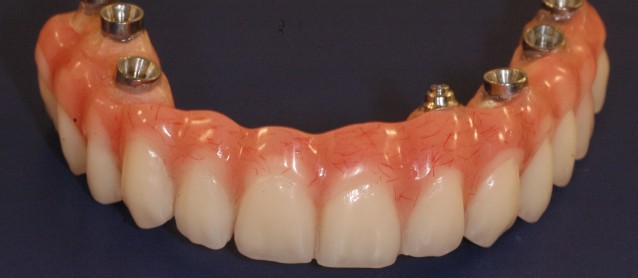 Denti del corredo 8 # delle penne della spazzola della porcellana del  laboratorio odontotecnico che modellano la penna di vetro materiale del  laboratorio odontotecnico strumenti 4 pz/scatola - AliExpress
